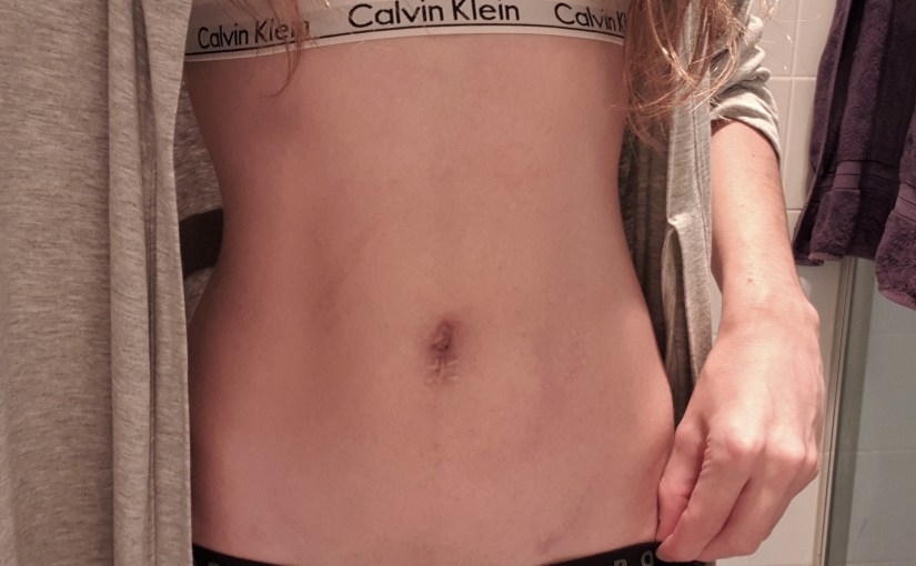 The Burden of&nbsp;Endometriosis